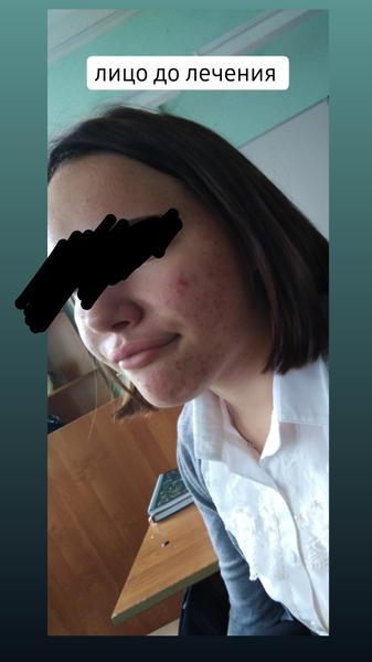 Помогли избавиться от главного комплекса