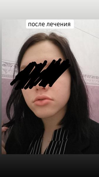 Помогли избавиться от главного комплекса
