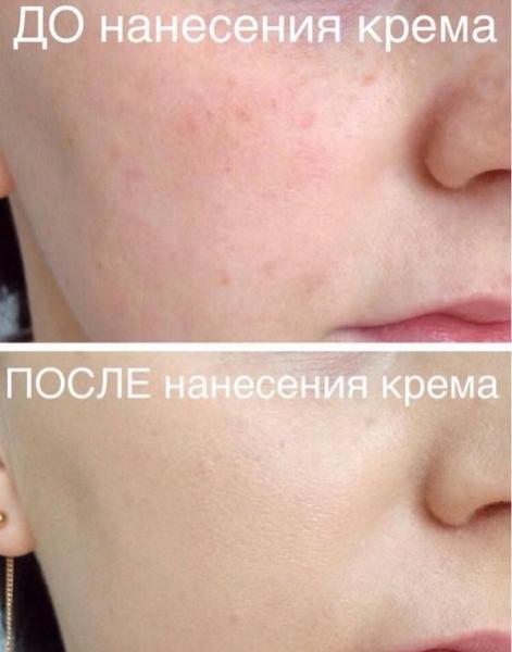 Крем отличный с тоном не прогадала мне подошёл всем советую.