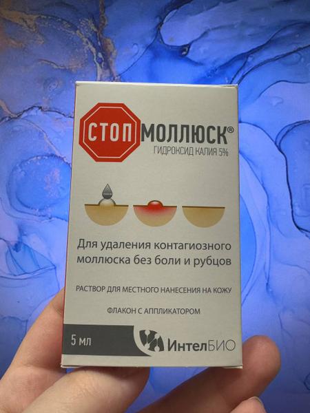 Избавилась от контагиозного моллюска без рубцов и боли